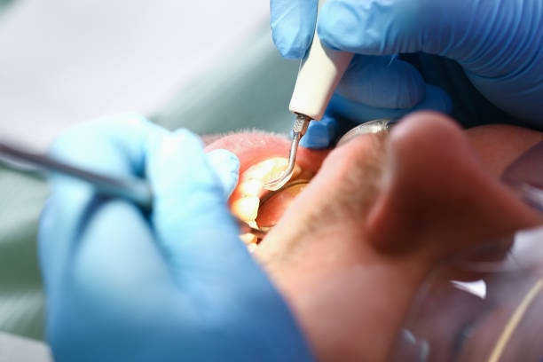 Best Emergency Dentist for Knocked-Out Tooth in Geneva, OH